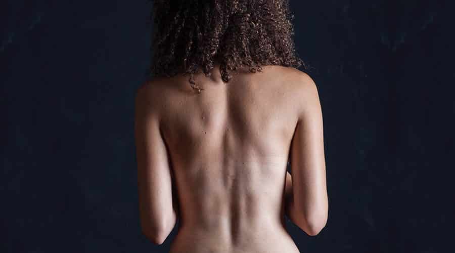 dolor lumbar, un caso clinico