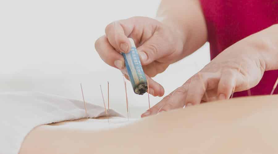 Acupuntura y moxibustión para el dolor lumbar